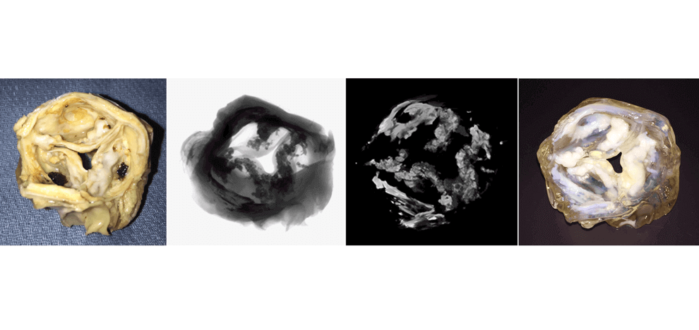 improved-diagnostics-presurgical-planning-high-resolution-functionally-graded-multi-material-3d-printing-biomedical-tomographic-datasets-4 improved-diagnostics-presurgical-planning-high-resolution-functionally-graded-multi-material-3d-printing-biomedical-tomographic-datasets-4